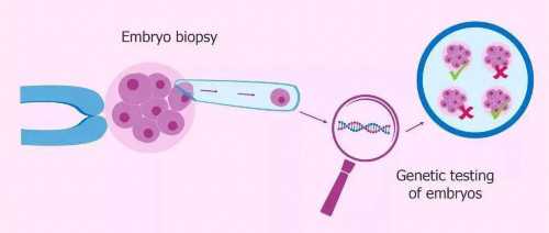 试管代生龙凤胎移植冻胚费用详解与代怀包成功指南