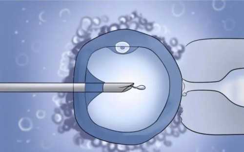 浙江三代助孕机构排名与移植流程详解，联系方式更新