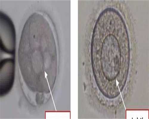 柬埔寨三代代生子机构医院费用十万预算是否充足及成功率分析