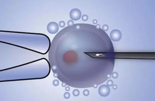 三代试管生宝宝准备费用十万足够吗？2~4万元解析