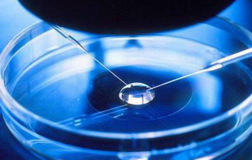 试管婴儿治疗前必须完成的检查项目详解