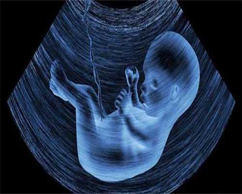 浙江省一二三代代生专业选择与费用明细解析