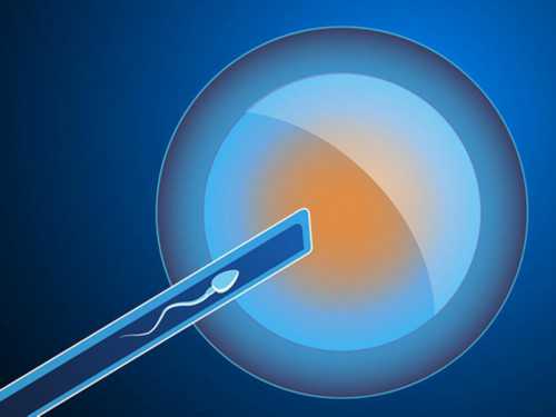促排卵期间停用DHEA以避免激素干扰卵泡发育