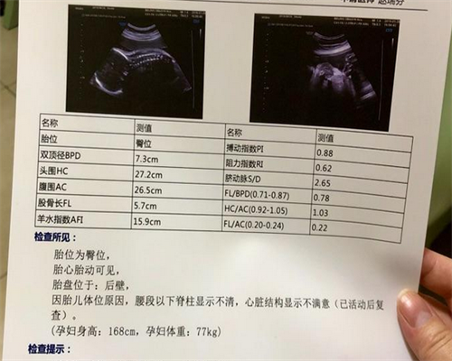 试管取卵禁忌人群解析：子宫疾病女性需先治疗再考虑助孕