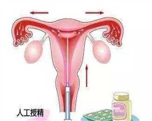 25岁卵巢早衰做试管婴儿成功率高吗？影响因素与提升策略