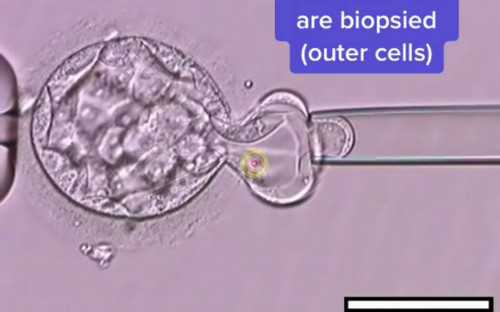 试管婴儿前的准备事项与流程详解