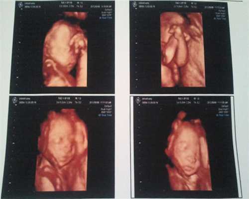 女性卵巢保养指南：延缓衰老与试管助孕选择