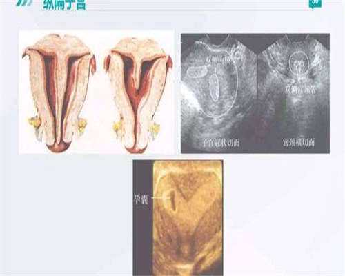 男性染色体缺失试管助孕方案解析与医院选择指南