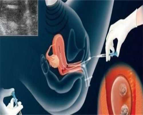 宫颈畸形试管助孕检查费用与成功率详解(子宫畸形试管助孕指南)